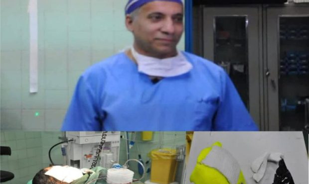 انجام عمل جراحی نادر ترمیم جمجمه با مواد اولیه استخوانی در مرکز آموزشی درمانی الزهرا